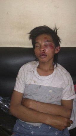 Curi Tas di Cafe, Fausan Dihajar Massa.