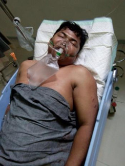 Fauzi Babak Belur di Hajar Kemanan Dan Sopir Pergudangan PT. Mitra Mandiri.