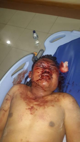 M.Suripto (35) Jambret Jalanan Babak Belur di Hajar Massa