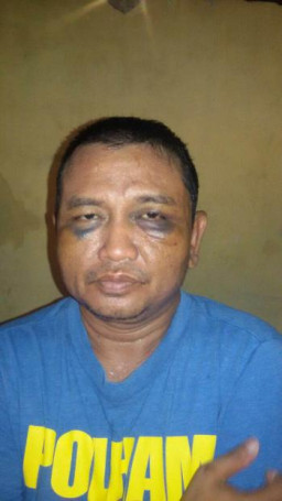 Banyu Bening Sutikno Nyonyor Dihajar Warga Saat Gagal Curi Motor di Undaan.