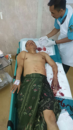 Calon Kades Samere di Hajar Pakai Pisau Dapur.