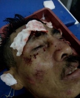 Diduga Begal, OTD Ini Hajar Warga Gayam Hingga Babak Belur, di Malam Takbir.