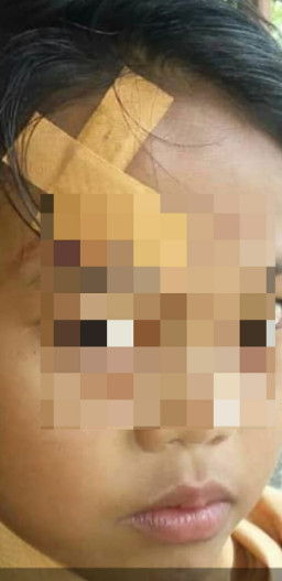 Oknum Guru MI NU Salafiyah Pelaku Penganiayaan, Resmi Dilaporkan ke Polisi.