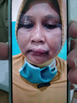 Sakti Bro! Pelaku Penganiaya Tetangga Tak Kunjung Berstatus Tersangka.