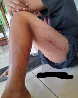 Aniaya Anak, Orang Tua Polisikan Anak Pengurus Panti Asuhan