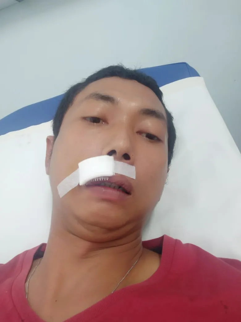 Sopir Taksi Online Babak Belur, Dihajar 2 Penumpangnya.