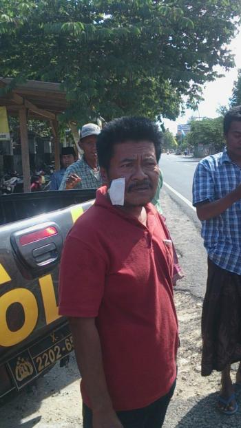 Gigit Mantan Kades Camplong, Beidi Terancam 5 Tahun Penjara
