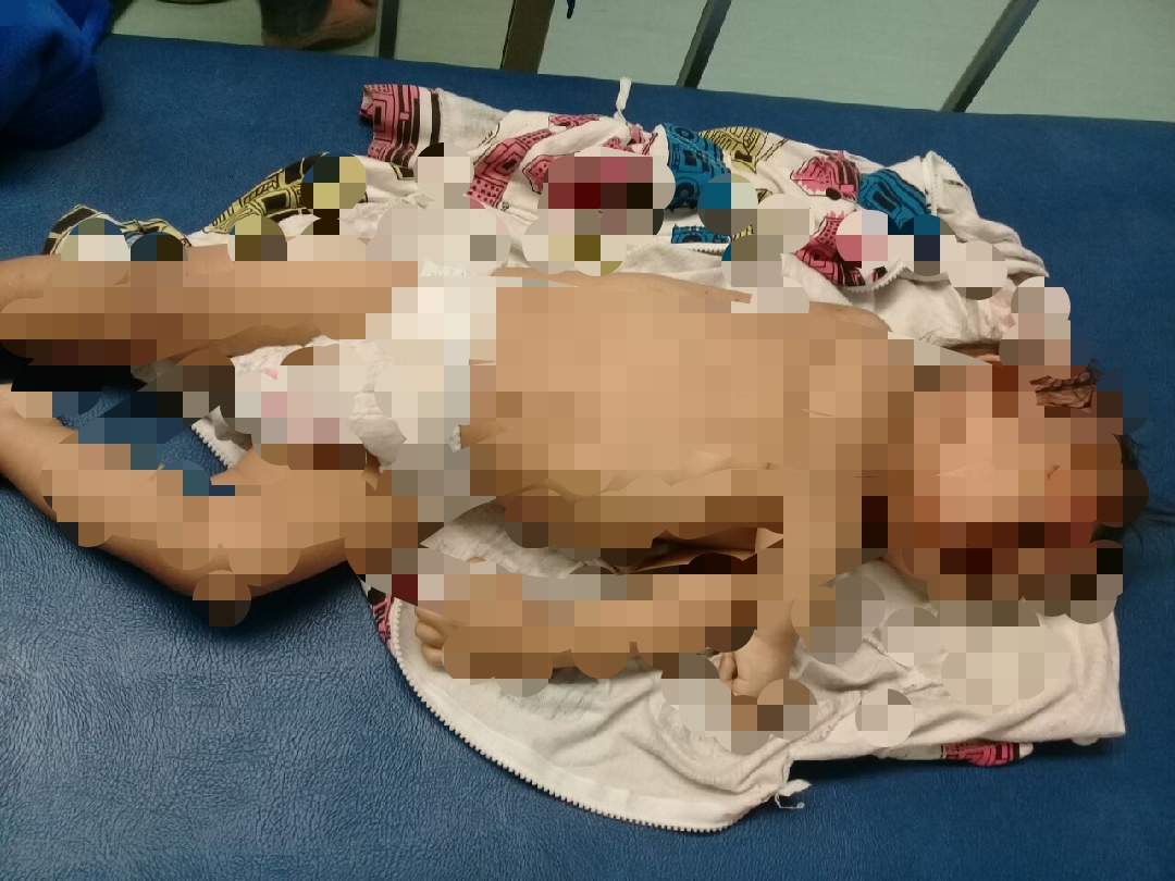 Biadab, Balita 16 Bulan Tewas di Tangan Ayah Kandungnya.