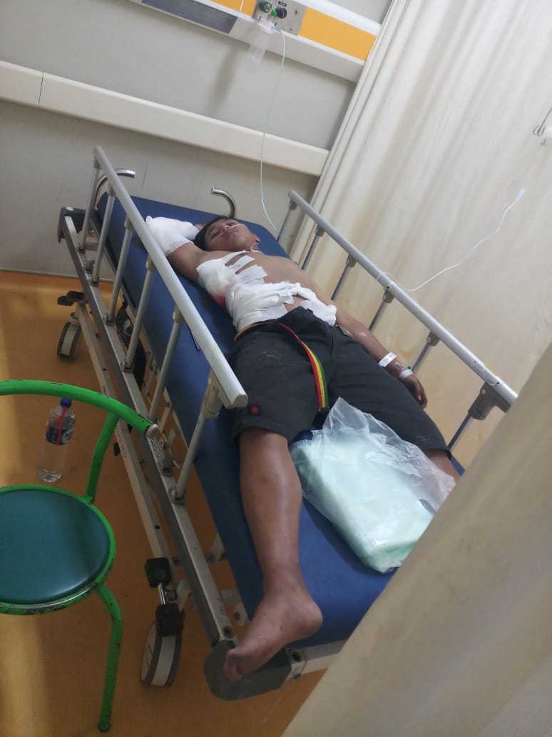 Pertunjukan Dangdut Berkhir Ricuh, 2 Pemuda di Lempar Bom Bondet.