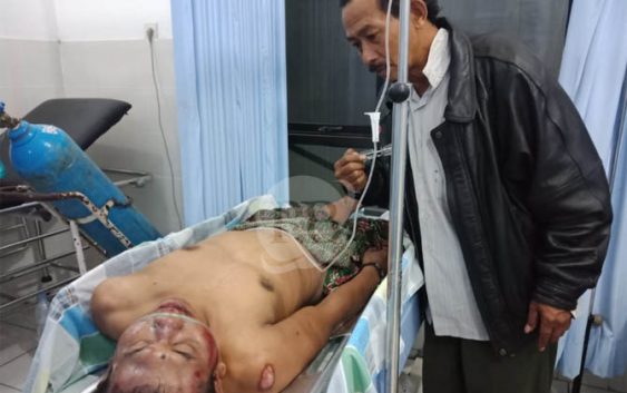 Kepergok Saat Curi Motor, Pria Ini Nyaris Tewas Dihajar Massa di Purwosari.