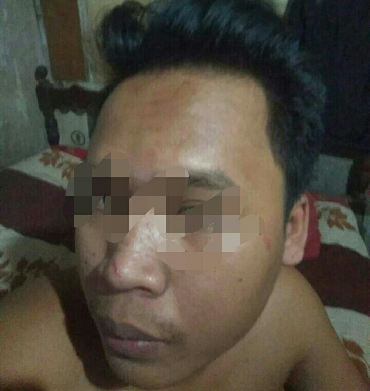 Karyawan Cafe di Surabaya Timur, di Serang 6 Pemuda