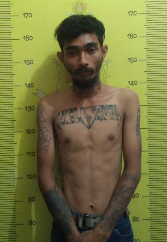 Diduga Kesal, Suami Ini Tega Aniaya Istri Hingga Lebam.